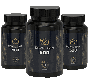 Royal Skin 500 - Kas tai